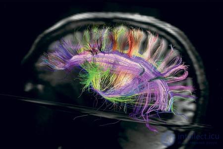 Мозг из машины США и Евросоюз форсируют исследования работы мозга