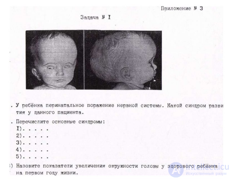 Перинатальная патология нервной системы.