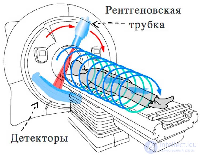 Новейший метод дающий точные и детальные изображения малейших изменений плотности мозгового вещества