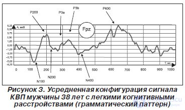 МУЛЬТИФОКАЛЬНЫЕ ВЫЗВАННЫЕ ПОТЕНЦИАЛЫ, СВЯЗАННЫЕ С СОБЫТИЕМ, В РАННЕЙ ДИАГНОСТИКЕ КОГНИТИВНОЙ ДЕЗИНТЕГРАЦИИ