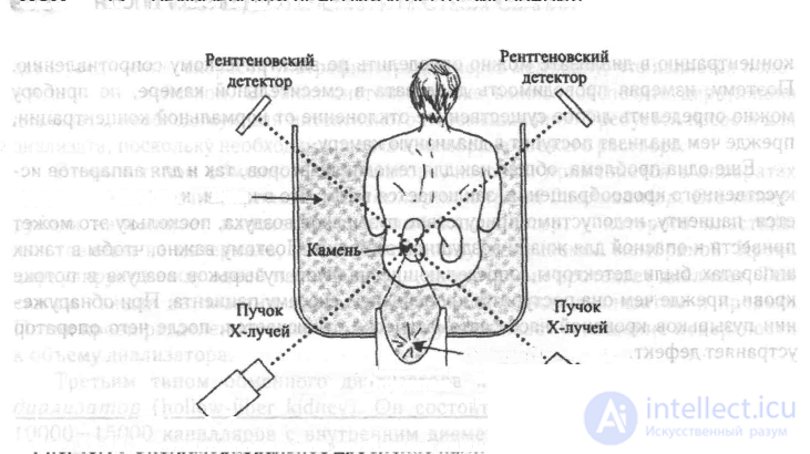 8. Возможности применения физических полей для разрушения биологических тканей. Лазерные, электронные и ультразвуковые скальпели