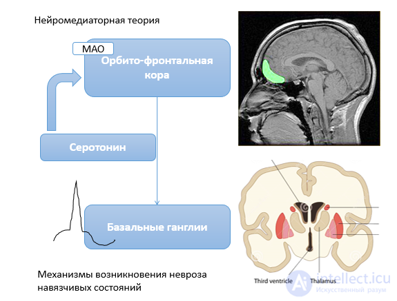 Невроз навязчивых состояний - признаки, механизмы, лечение