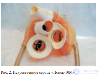 Аппаратура для поддержки кровообращения, искусственное сердце