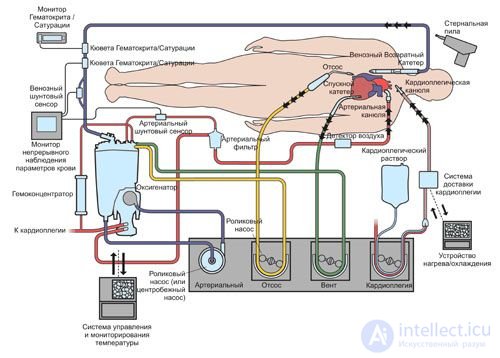 Аппаратура для поддержки кровообращения, искусственное сердце