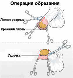 обрезание